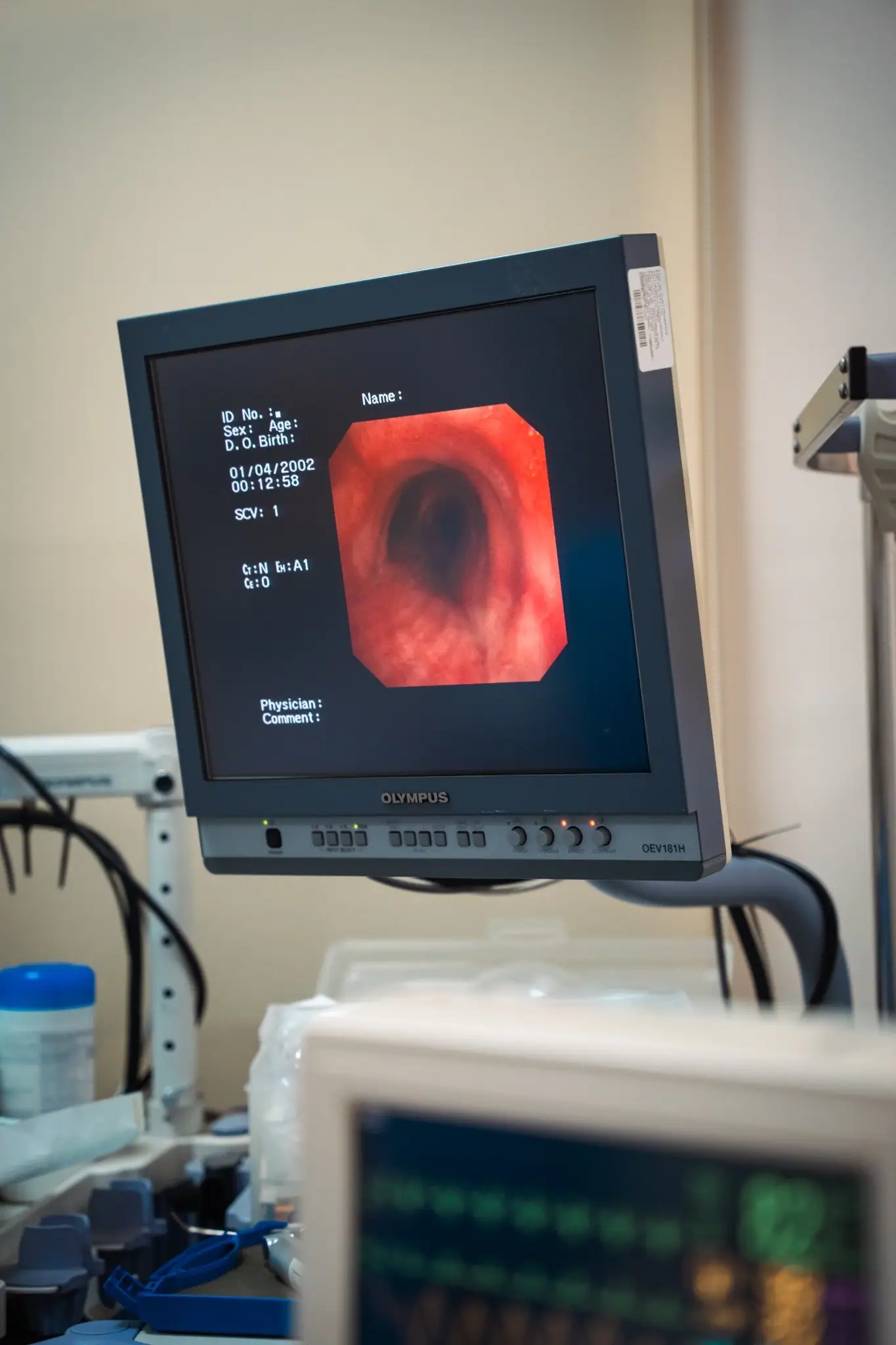 Fiberoptik Bronkoskopi nedir? Nasıl Uygulanır?